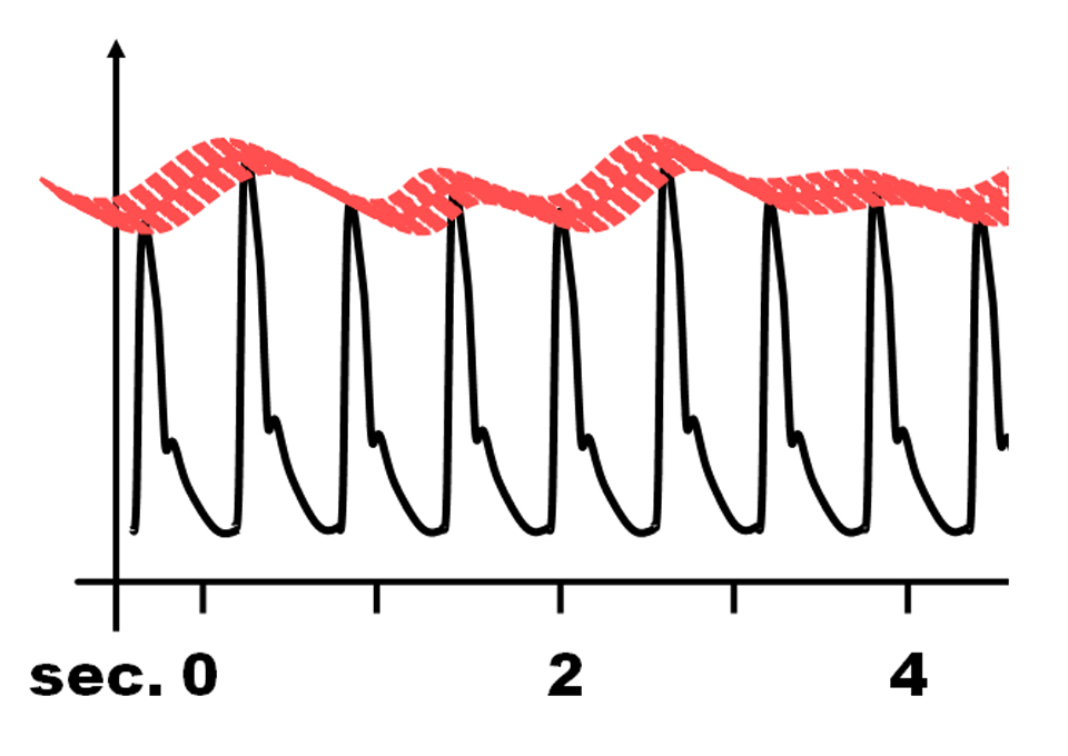 Blutdruckschwankung im Minutentakt