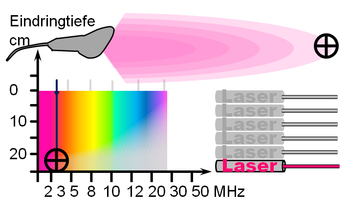 Ultraschallsonde