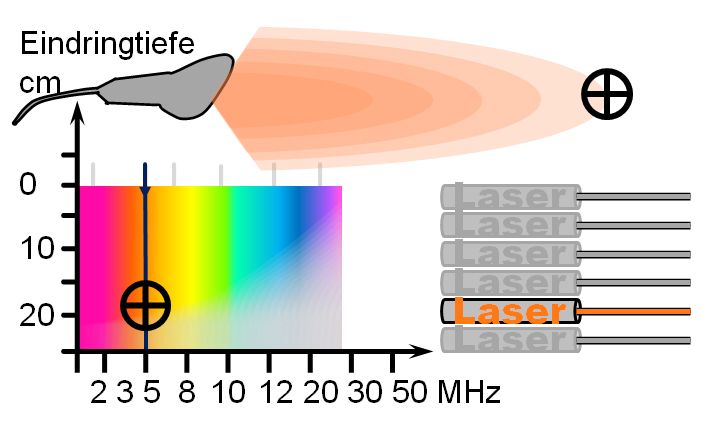 Ultraschallsonde