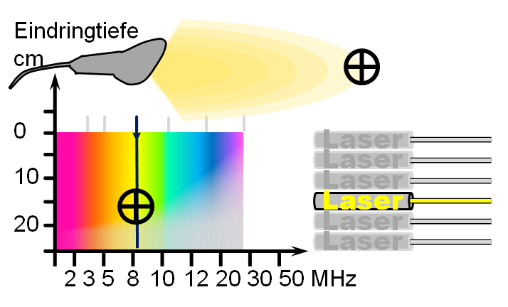 Ultraschallsonde