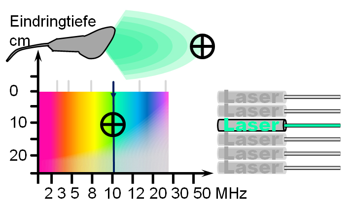 Ultraschallsonde