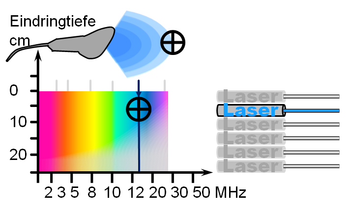 Ultraschallsonde