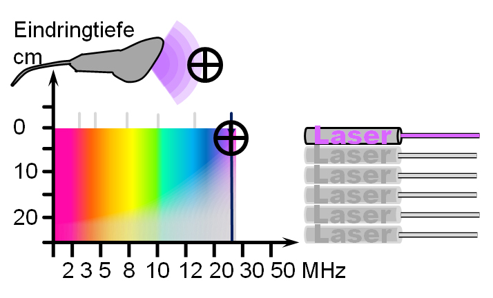 Ultraschallsonde